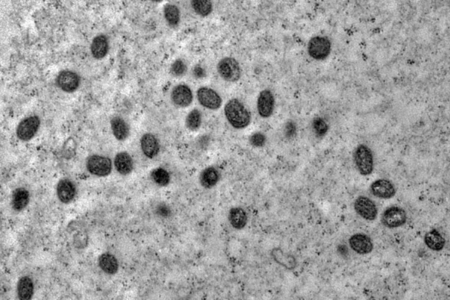 Casos de mpox no Brasil este ano já superam o total de 2023