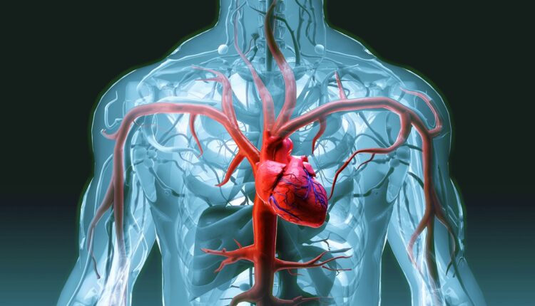 nova classificacao do infarto divide a doenca em tres tipos