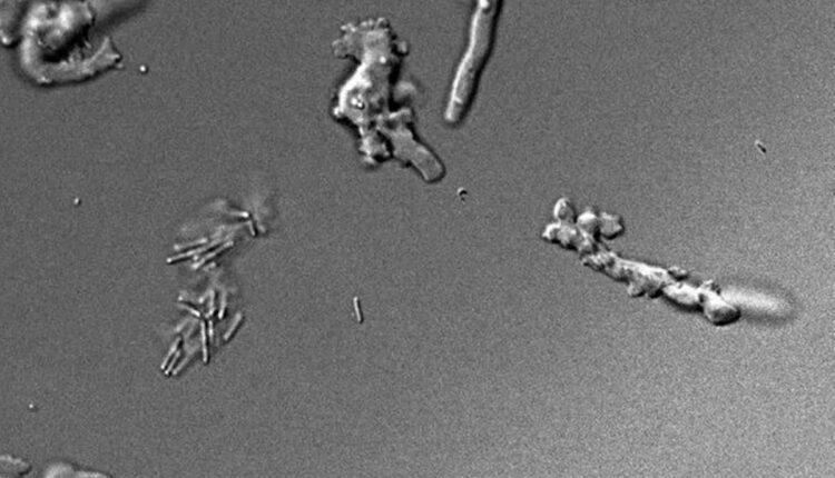 Imagem microscópica de amebas