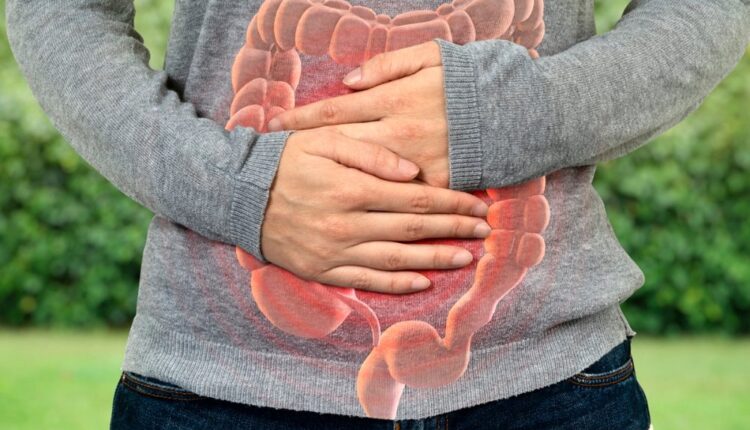 Câncer de intestino antes dos 50 tem tumor diferente e mais sobrevida