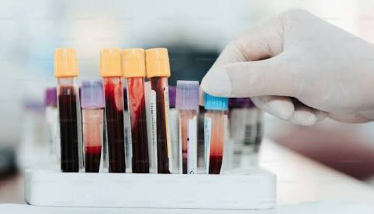 Tubos de amostras de sangue em laboratório