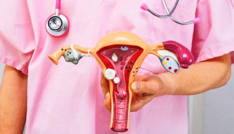 Modelo do sistema reprodutor feminino em consulta médica