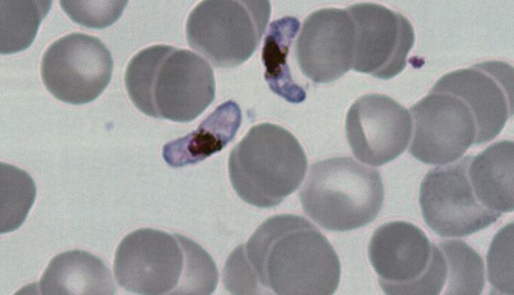 Glóbulos vermelhos infectados pelo parasita da malária vistos ao microscópio